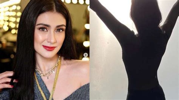 Carla Abellana